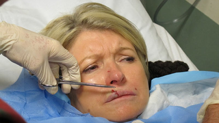 Martha Stewart Gets Stitches After Headbutt From French Bulldog